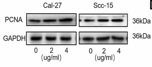 Western blot analysis of PCNA, GAPDH in OSCC cells.jpg